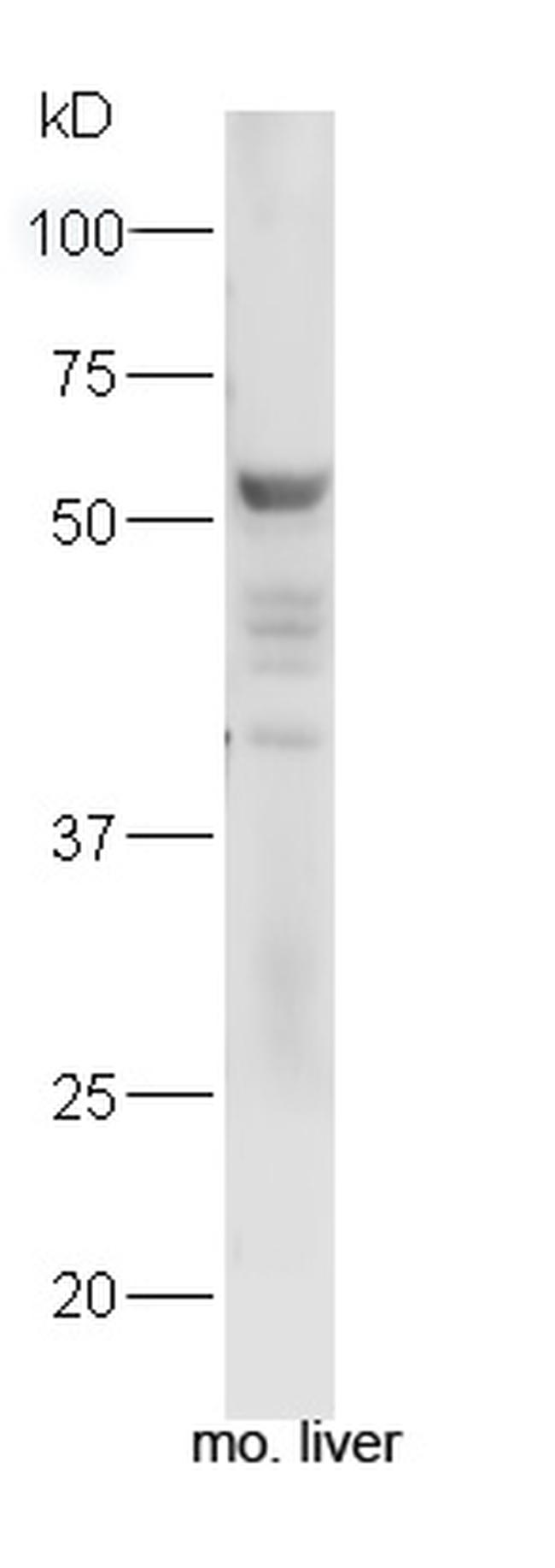 Fibrinogen alpha chain Antibody in Western Blot (WB)