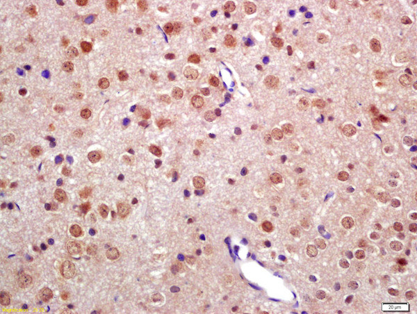 TNIP2 Antibody in Immunohistochemistry (Paraffin) (IHC (P))