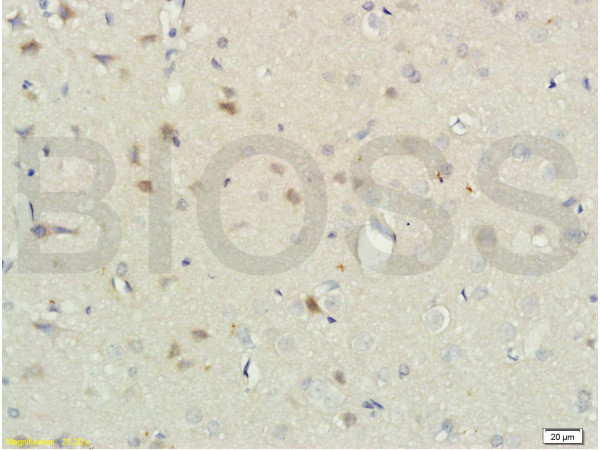 RNF122 Antibody in Immunohistochemistry (Paraffin) (IHC (P))