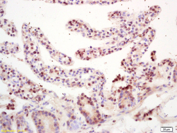 RNF36 Antibody in Immunohistochemistry (Paraffin) (IHC (P))
