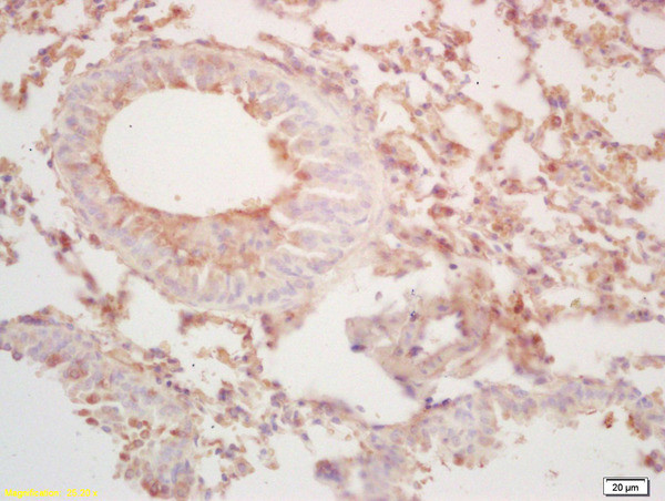 BCL2L14 Antibody in Immunohistochemistry (Paraffin) (IHC (P))
