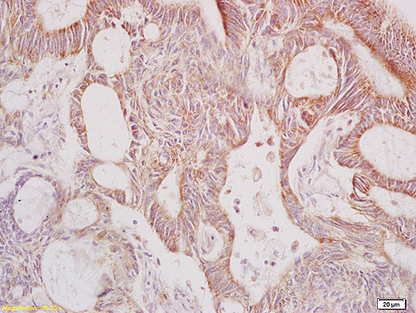 Galactosidase alpha Antibody in Immunohistochemistry (Paraffin) (IHC (P))