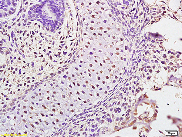 ATAD5 Antibody in Immunohistochemistry (Paraffin) (IHC (P))