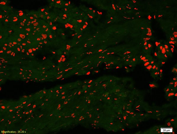 IDO1 Antibody in Immunohistochemistry (Paraffin) (IHC (P))