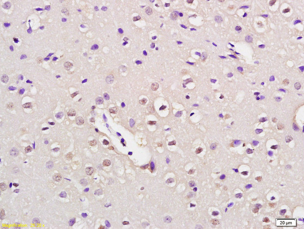 NUP50 Antibody in Immunohistochemistry (Paraffin) (IHC (P))