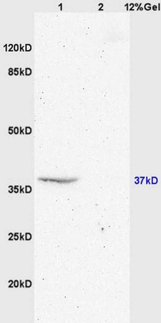 GPR55 Antibody in Western Blot (WB)