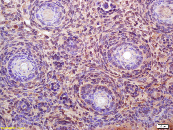 CDCA1 Antibody in Immunohistochemistry (Paraffin) (IHC (P))