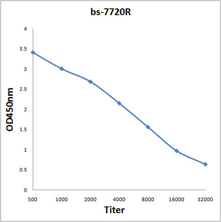 DSCC1 Antibody in ELISA (ELISA)