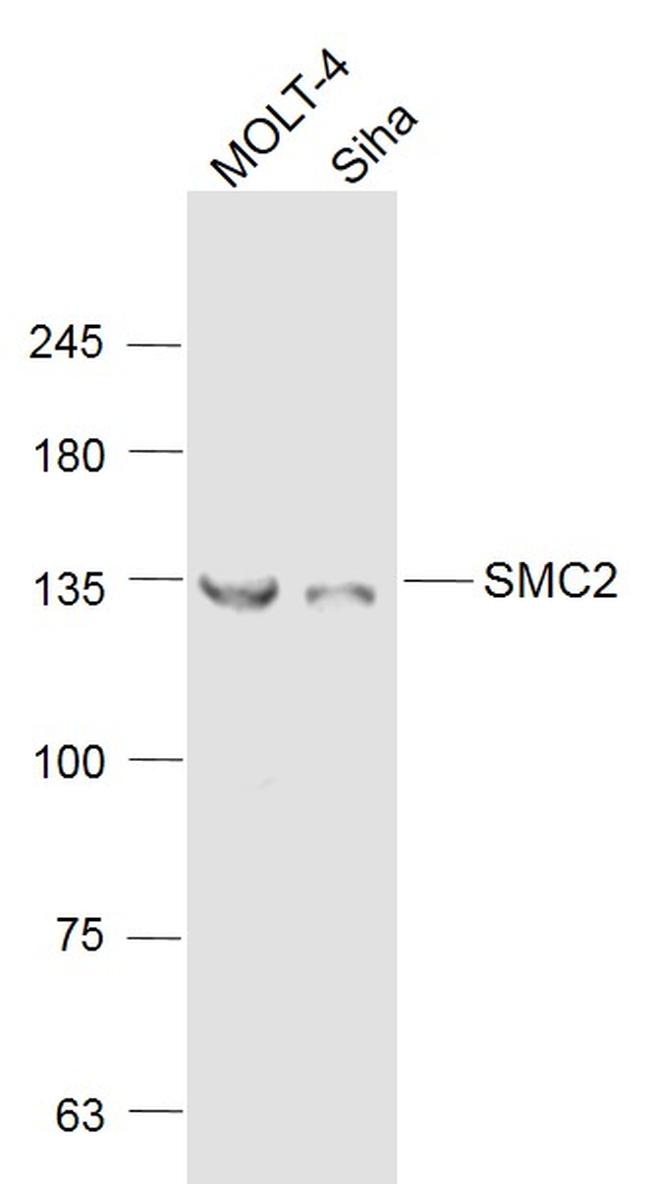 SMC2 Antibody in Western Blot (WB)