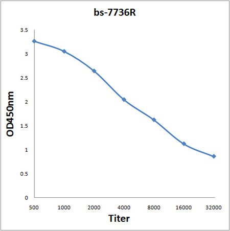ASB3 Antibody in ELISA (ELISA)