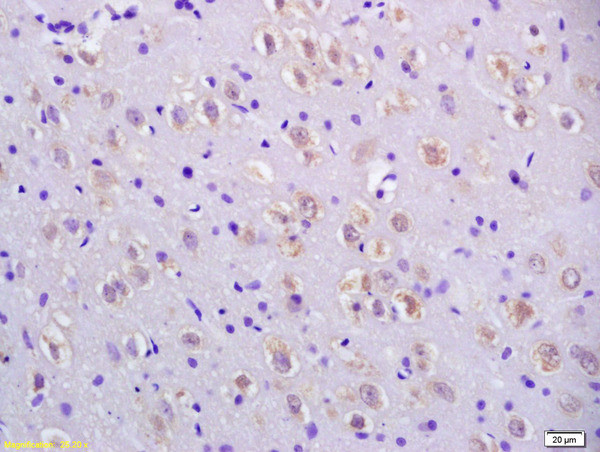 CCDC11 Antibody in Immunohistochemistry (Paraffin) (IHC (P))