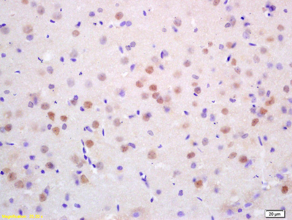 CDC10 Antibody in Immunohistochemistry (Paraffin) (IHC (P))