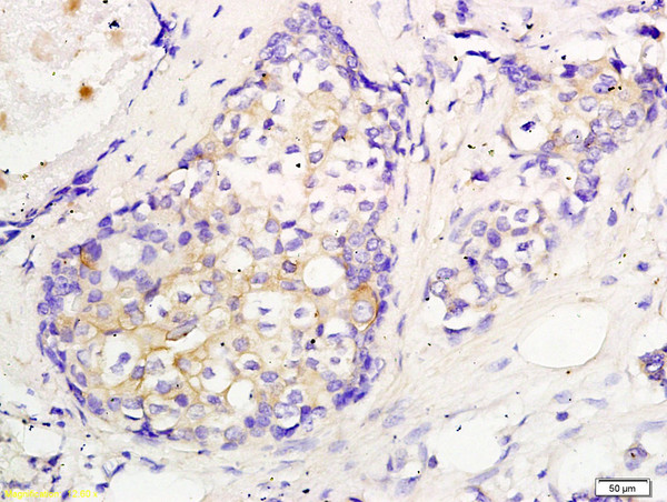 CEP55 Antibody in Immunohistochemistry (Paraffin) (IHC (P))