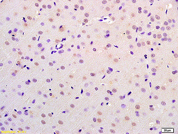 CHMP4B+CHMP4C Antibody in Immunohistochemistry (Paraffin) (IHC (P))