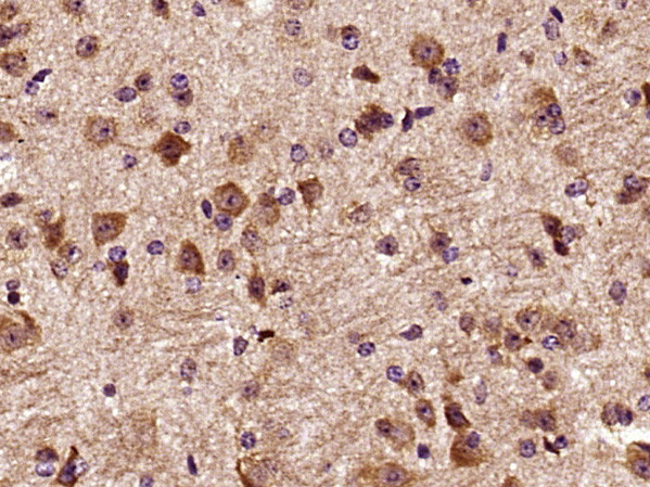 DCTN3 Antibody in Immunohistochemistry (Paraffin) (IHC (P))