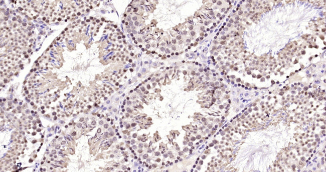 NEK7 Antibody in Immunohistochemistry (Paraffin) (IHC (P))