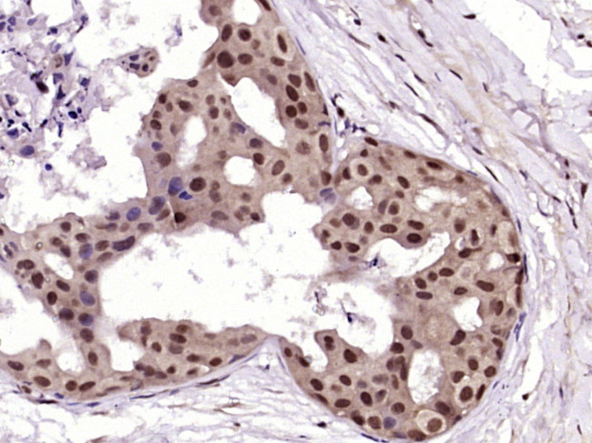 RAB35 Antibody in Immunohistochemistry (Paraffin) (IHC (P))