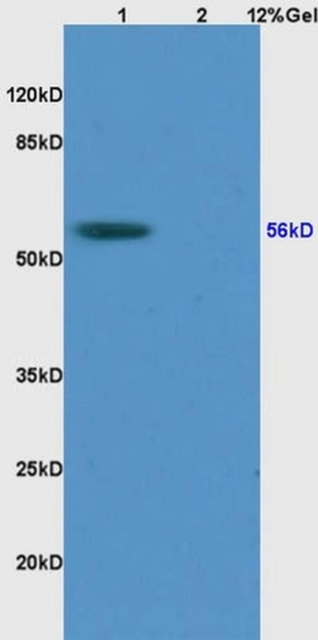 RCC2 Antibody in Western Blot (WB)