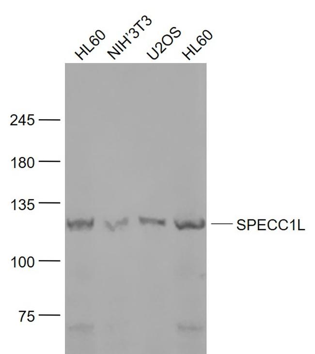 SPECC1L Antibody in Western Blot (WB)