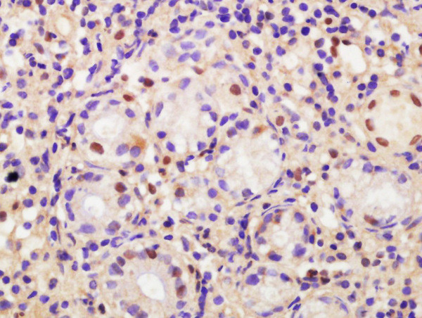 CDCA2 Antibody in Immunohistochemistry (Paraffin) (IHC (P))