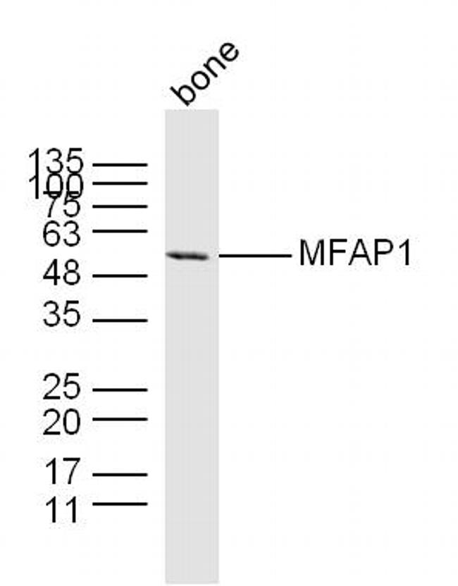 MFAP1 Antibody in Western Blot (WB)
