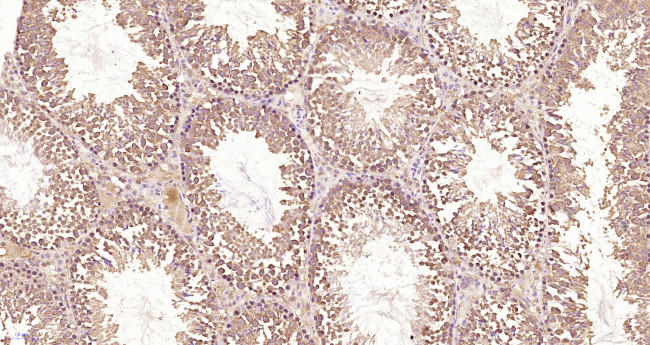 NUP37 Antibody in Immunohistochemistry (Paraffin) (IHC (P))
