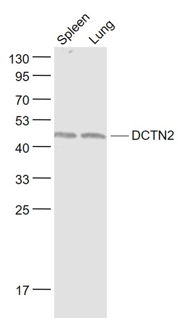 DCTN2 Antibody in Western Blot (WB)