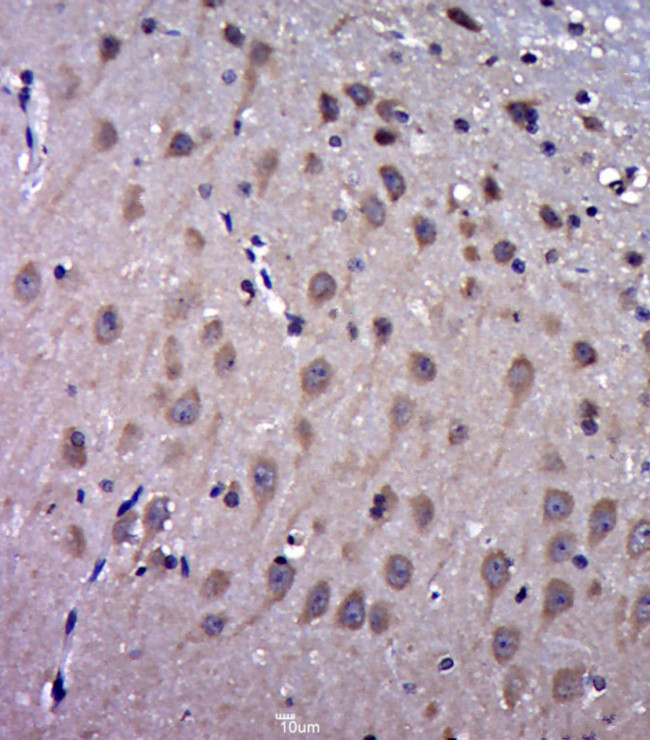 FAM3C Antibody in Immunohistochemistry (Paraffin) (IHC (P))