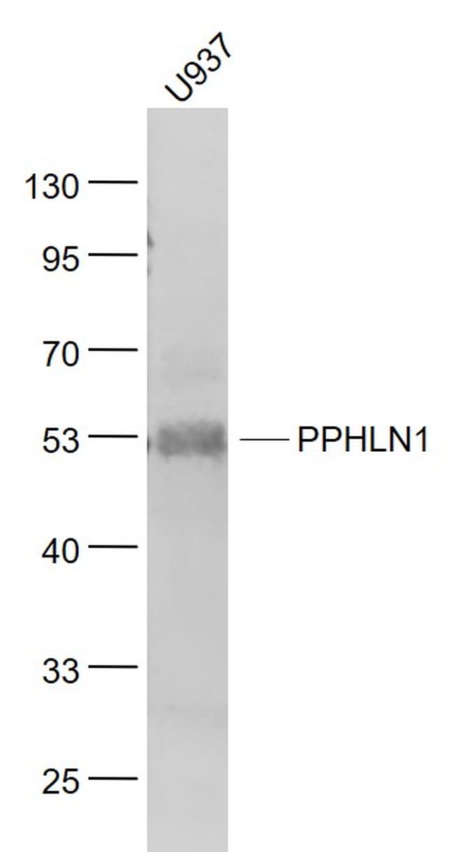 PPHLN1 Antibody in Western Blot (WB)