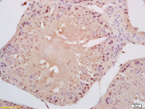 Cyclin B3 Antibody in Immunohistochemistry (Paraffin) (IHC (P))