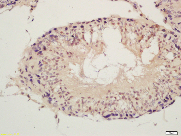 SPDYA Antibody in Immunohistochemistry (Paraffin) (IHC (P))