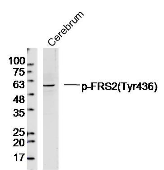 Phospho-FRS2 (Tyr436) Antibody in Western Blot (WB)