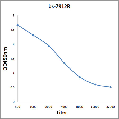 GAK protein Antibody in ELISA (ELISA)