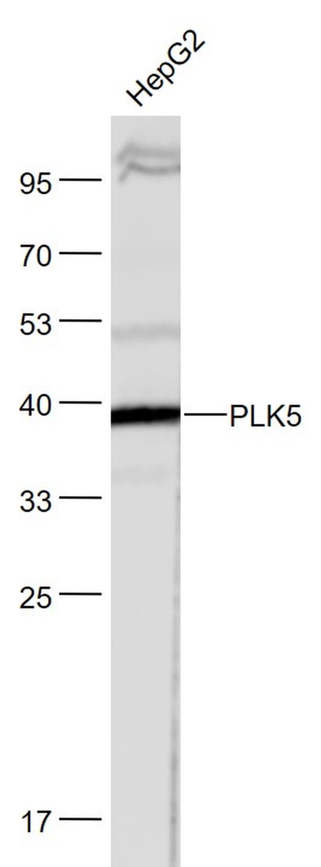 PLK5 Antibody in Western Blot (WB)