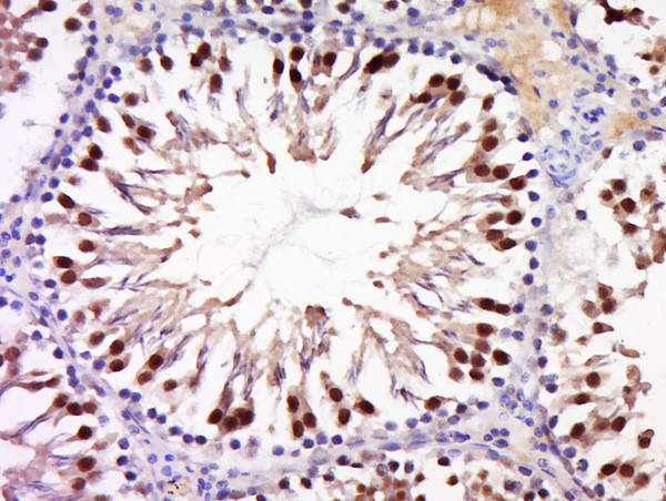 ANKRD28 Antibody in Immunohistochemistry (Paraffin) (IHC (P))