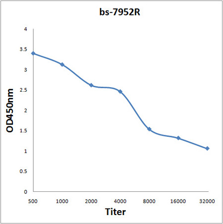 ADCK2 Antibody in ELISA (ELISA)