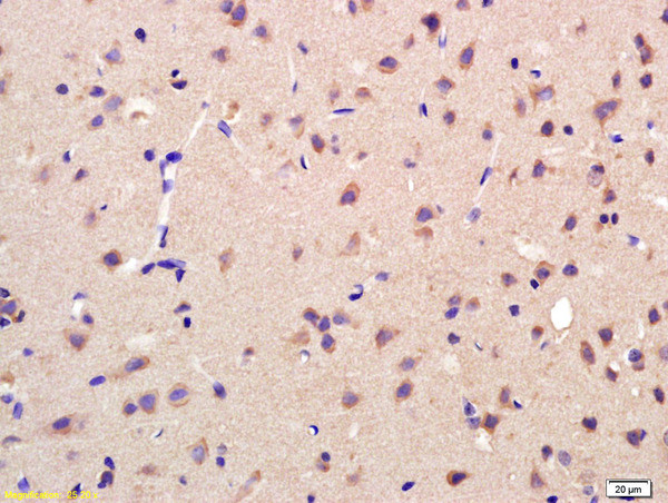 AKR1A1 Antibody in Immunohistochemistry (Paraffin) (IHC (P))
