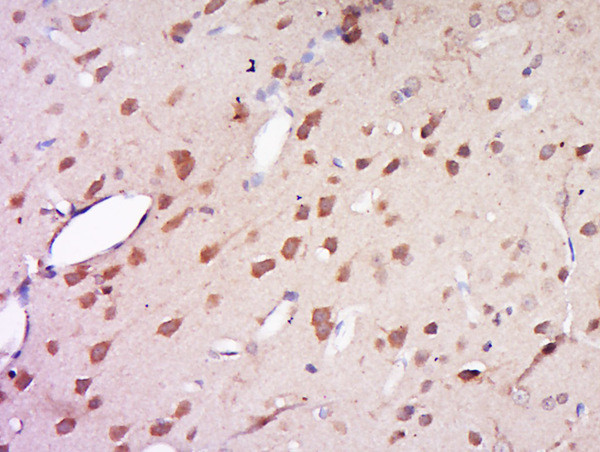 AMN1 Antibody in Immunohistochemistry (Paraffin) (IHC (P))