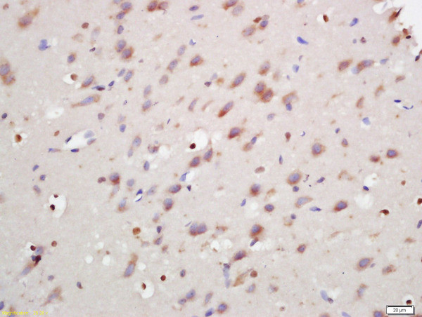 ANKRD9 Antibody in Immunohistochemistry (Paraffin) (IHC (P))