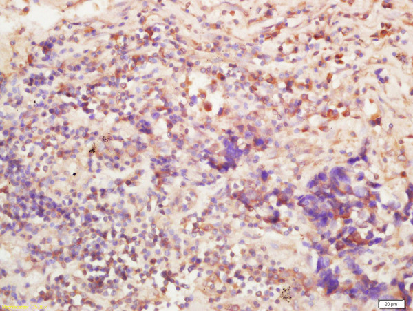 BTBD7 Antibody in Immunohistochemistry (Paraffin) (IHC (P))