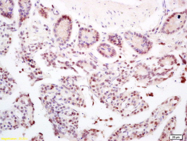 CCDC7 Antibody in Immunohistochemistry (Paraffin) (IHC (P))