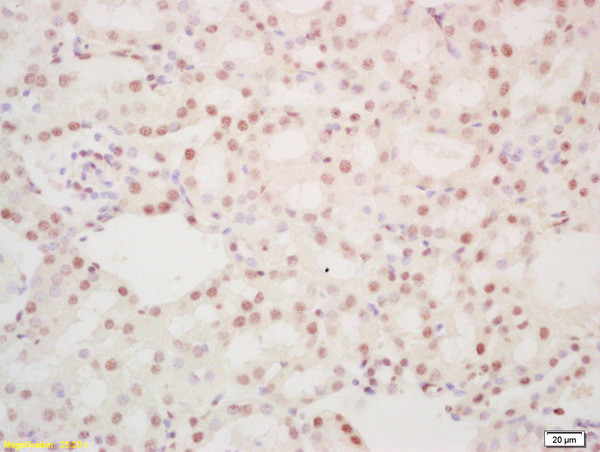 Phospho-DDX5 (Tyr593) Antibody in Immunohistochemistry (Paraffin) (IHC (P))