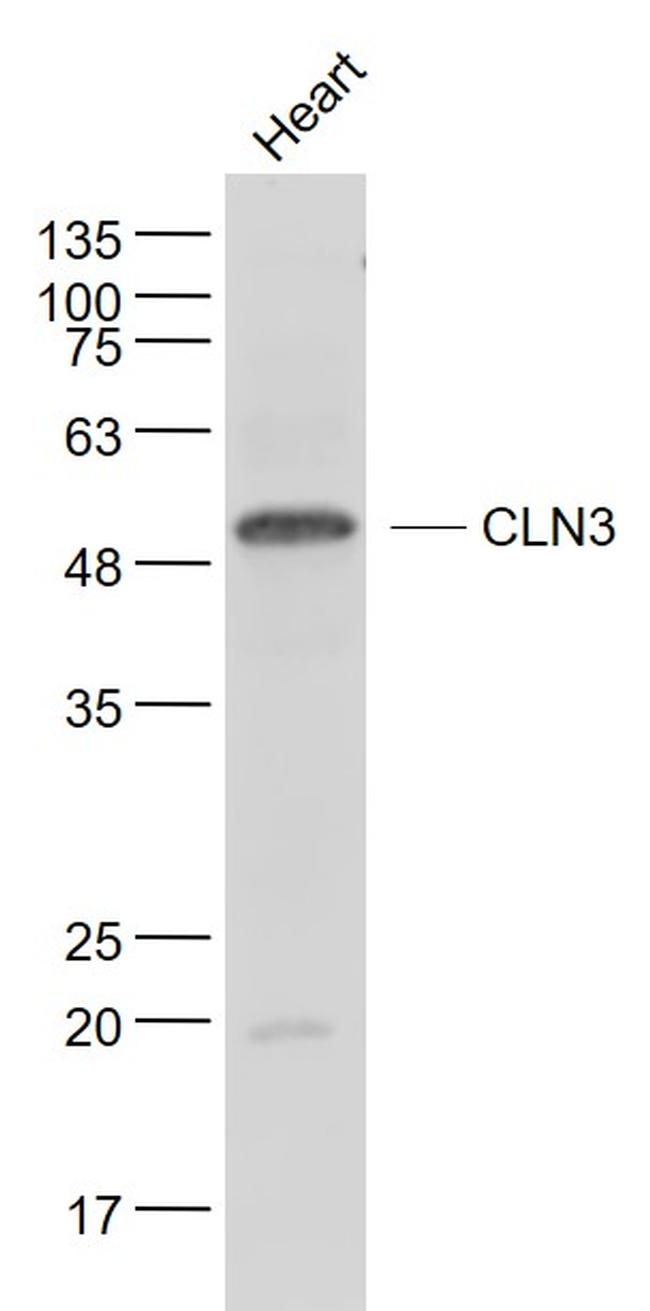 CLN3 Antibody in Western Blot (WB)