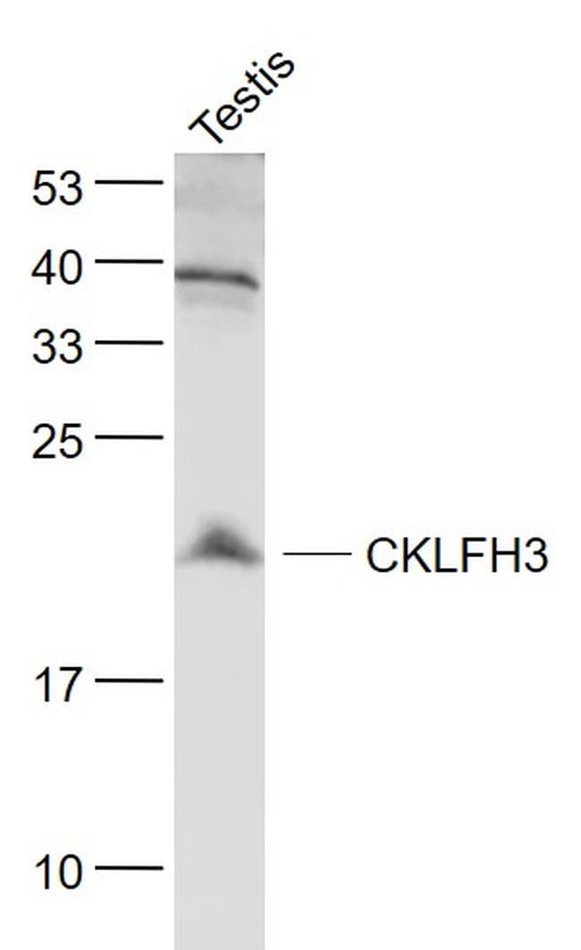 CKLFH3 Antibody in Western Blot (WB)