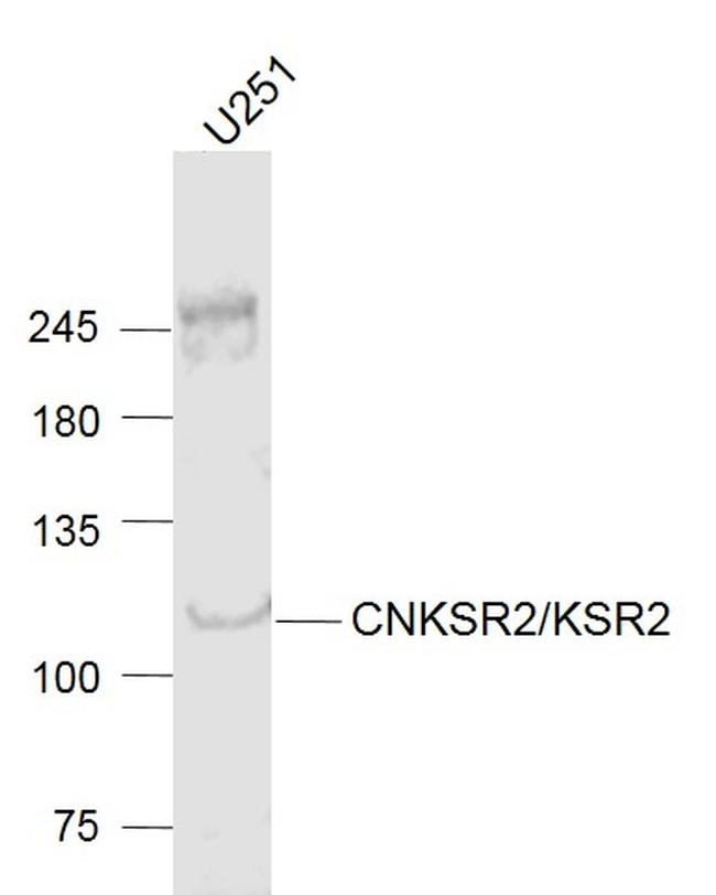 CNKSR2 Antibody in Western Blot (WB)