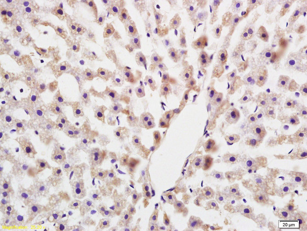 COLEC10 Antibody in Immunohistochemistry (Paraffin) (IHC (P))
