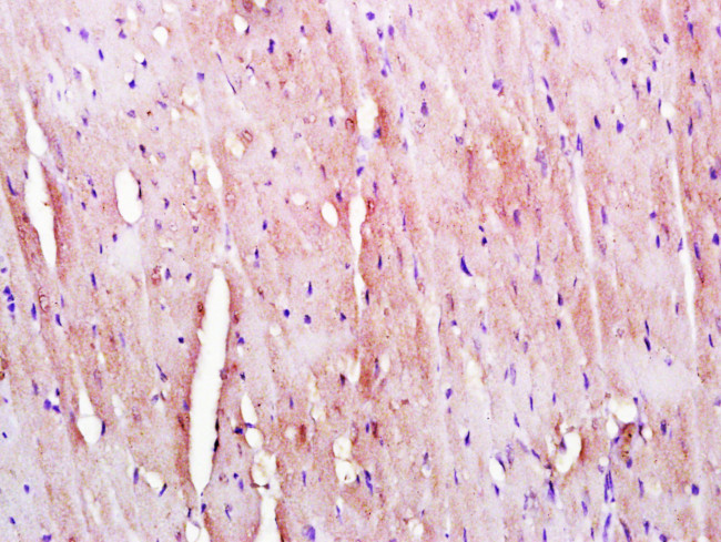 KLHL24 Antibody in Immunohistochemistry (Paraffin) (IHC (P))