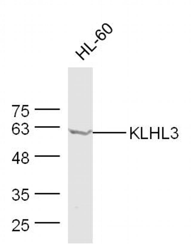 KLHL3 Antibody in Western Blot (WB)