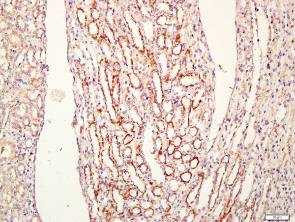 CEMIP Antibody in Immunohistochemistry (Paraffin) (IHC (P))