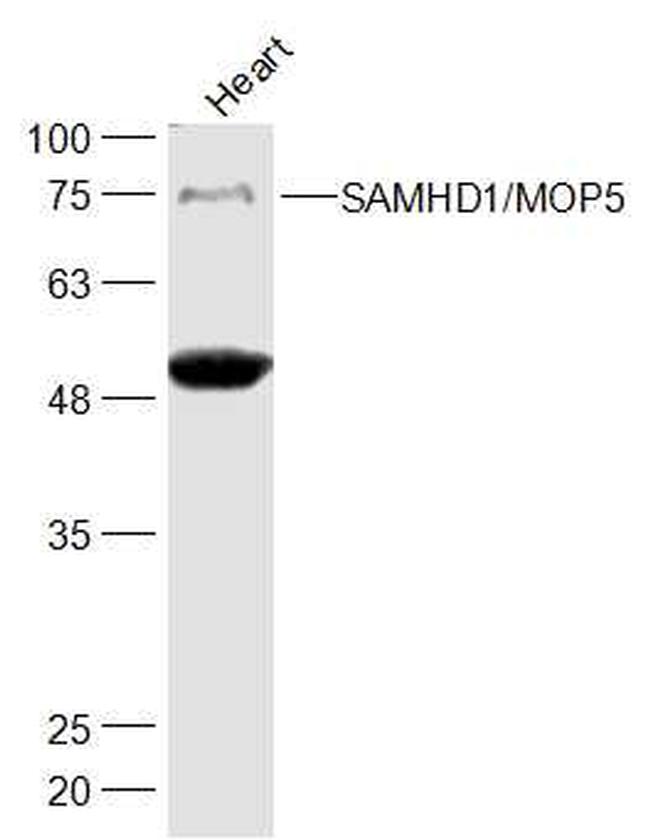 SAMHD1 Antibody in Western Blot (WB)